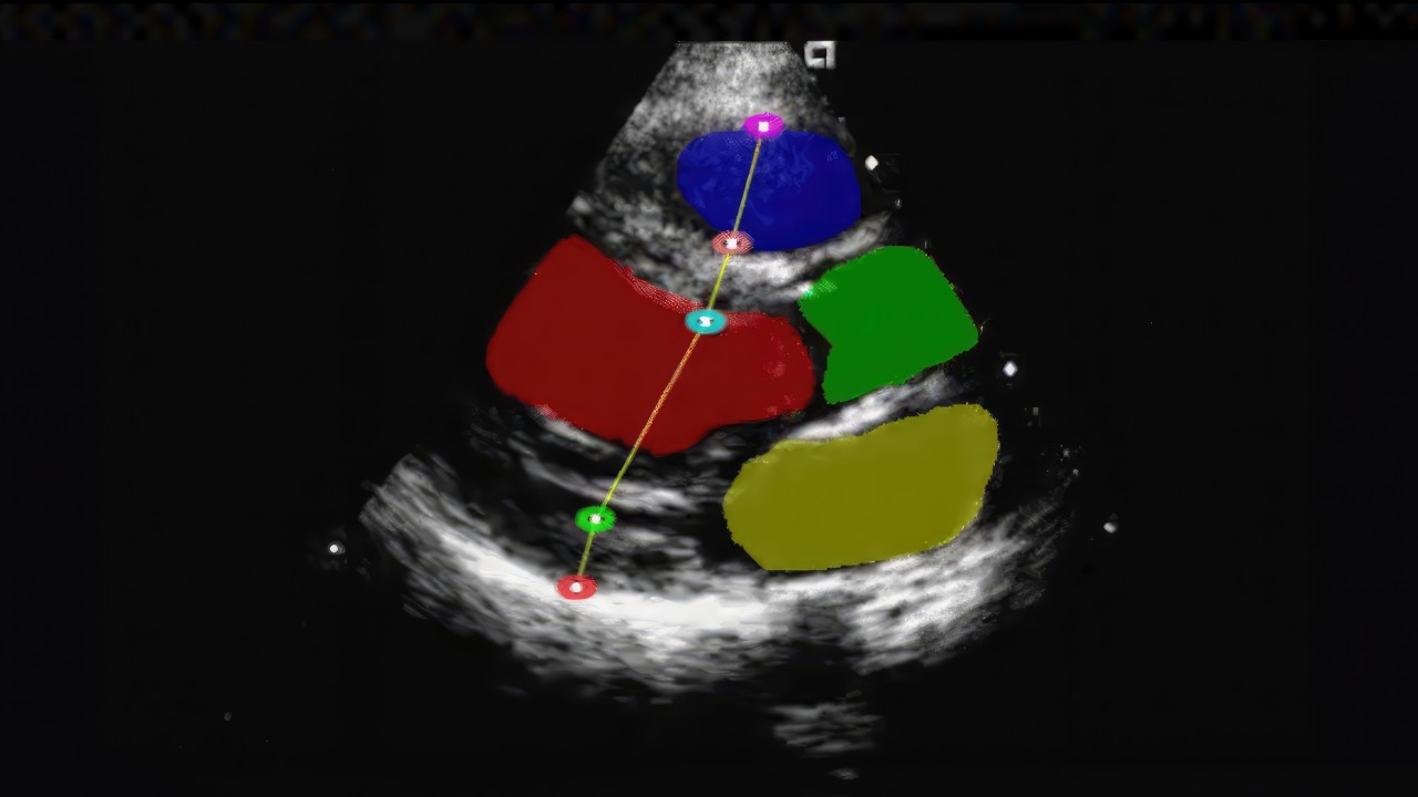 Build and deploy solutions across medical imaging, sensor processing, and more.